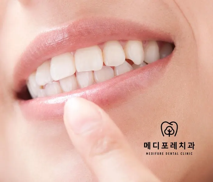 손가락으로 아랫니 잇몸을 가리키는 입 주변 확대 사진